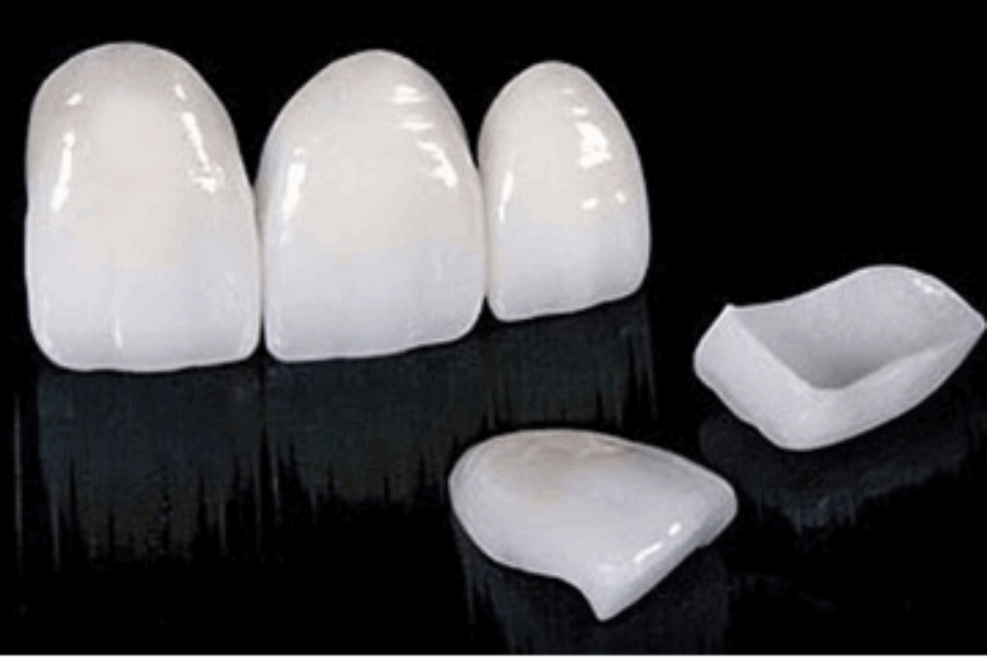 Tendencias en Estética Dental: ¿Qué Buscan las Celebridades?