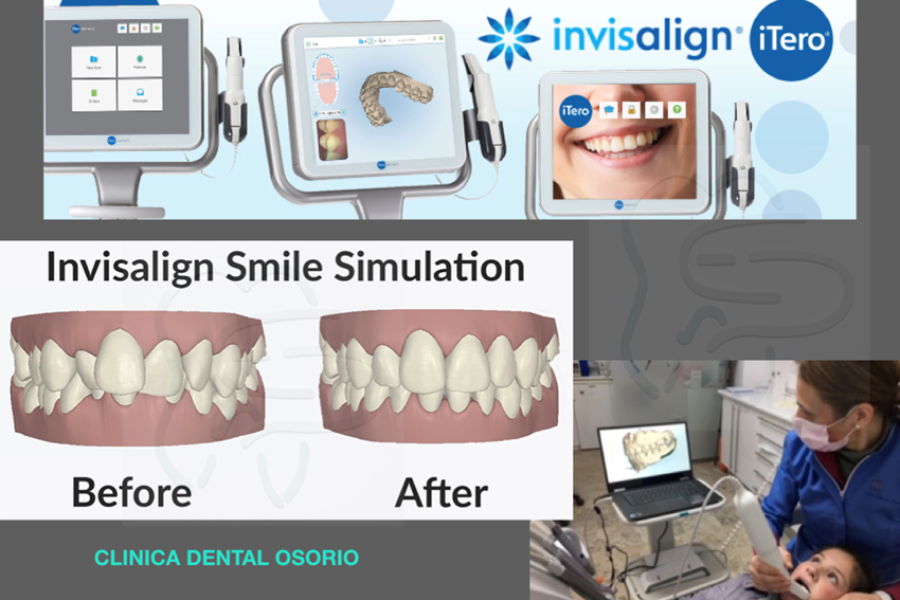 Beneficios de la odontología digital